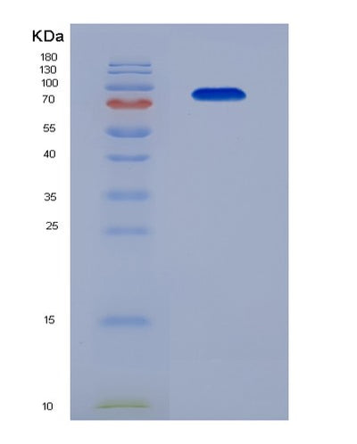 SDS-PAGE analysis of Human PLG (Plasminogen) - Recombinant Protein, CAT# BLT-07254P, showing >90% purity under 15% SDS-PAGE (Reduced)Human PLG (Plasminogen) - Recombinant Protein