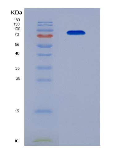 SDS-PAGE analysis of Human PLG (Plasminogen) - Recombinant Protein, CATHuman PLG (Plasminogen) - Recombinant Protein