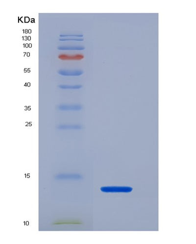 SDS-PAGE analysis of Human HNRNPA2B1 (Heterogeneous Nuclear Ribonucleoproteins A2/B1) - Recombinant Protein, CAT# BLT-07255P, showing >90% purity under 15% SDS-PAGE (Reduced)Human HNRNPA2B1 (Heterogeneous Nuclear Ribonucleoproteins A2/B1) - Recombinant Protein