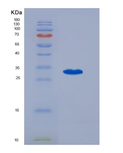 SDS-PAGE analysis of Human ABCB1 (Atp-Dependent Translocase Abcb1) - Recombinant Protein, CAT# BLT-07256P, showing >90% purity under 15% SDS-PAGE (Reduced)Human ABCB1 (Atp-Dependent Translocase Abcb1) - Recombinant Protein