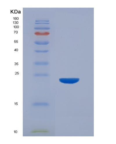 SDS-PAGE analysis of Human CASP7 (Caspase-7) - Recombinant Protein, CAT# BLT-07257P, showing >90% purity under 15% SDS-PAGE (Reduced)Human CASP7 (Caspase-7) - Recombinant Protein