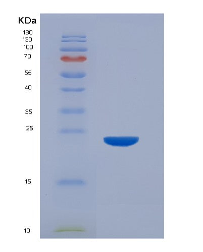 SDS-PAGE analysis of Human CASP7 (Caspase-7) - Recombinant Protein, CATHuman CASP7 (Caspase-7) - Recombinant Protein