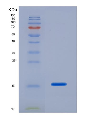 SDS-PAGE analysis of Human CASP7 (Caspase-7) - Recombinant Protein, CAT# BLT-07258P, showing >90% purity under 15% SDS-PAGE (Reduced)Human CASP7 (Caspase-7) - Recombinant Protein