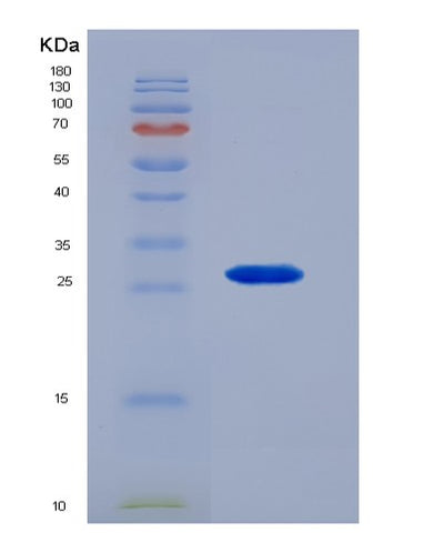 SDS-PAGE analysis of Human KLK4 (Kallikrein-4) - Recombinant Protein, CAT# BLT-07260P, showing >90% purity under 15% SDS-PAGE (Reduced)Human KLK4 (Kallikrein-4) - Recombinant Protein