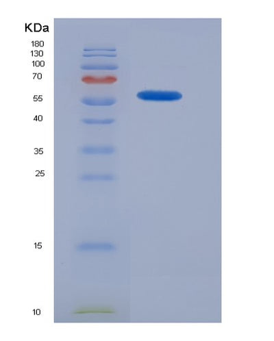 SDS-PAGE analysis of Mouse Ntn1 (Netrin-1) - Recombinant Protein, CAT# BLT-07263P, showing >90% purity under 15% SDS-PAGE (Reduced)Mouse Ntn1 (Netrin-1) - Recombinant Protein