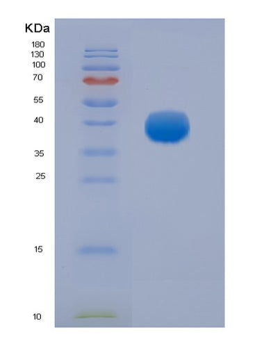 SDS-PAGE analysis of Human FCGR3A (Low Affinity Immunoglobulin Gamma Fc Region Receptor Iii-A) - Recombinant Protein, CAT# BLT-03643P, showing >90% purity under 15% SDS-PAGE (Reduced)Human FCGR3A (Low Affinity Immunoglobulin Gamma Fc Region Receptor Iii-A) - Recombinant Protein