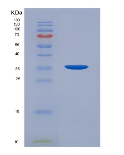 SDS-PAGE analysis of Human AR (Androgen Receptor) - Recombinant Protein, CAT# BLT-07264P, showing >90% purity under 15% SDS-PAGE (Reduced)Human AR (Androgen Receptor) - Recombinant Protein