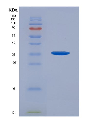 SDS-PAGE analysis of Human AR (Androgen Receptor) - Recombinant Protein, CATHuman AR (Androgen Receptor) - Recombinant Protein
