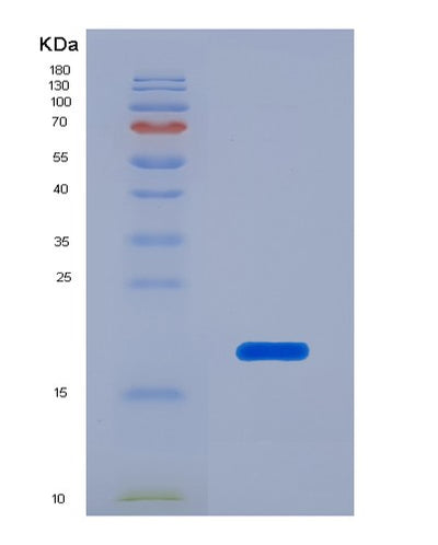 SDS-PAGE analysis of Human APP (Amyloid-Beta Precursor Protein) - Recombinant Protein, CAT# BLT-07269P, showing >90% purity under 15% SDS-PAGE (Reduced)Human APP (Amyloid-Beta Precursor Protein) - Recombinant Protein