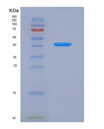 SDS-PAGE analysis of Human TFR2 (Transferrin Receptor Protein 2) - Recombinant Protein, CAT# BLT-07270P, showing >90% purity under 15% SDS-PAGE (Reduced)Human TFR2 (Transferrin Receptor Protein 2) - Recombinant Protein