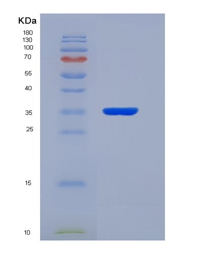 SDS-PAGE analysis of Mouse Lyve1 (Lymphatic Vessel Endothelial Hyaluronic Acid Receptor 1) - Recombinant Protein, CATMouse Lyve1 (Lymphatic Vessel Endothelial Hyaluronic Acid Receptor 1) - Recombinant Protein