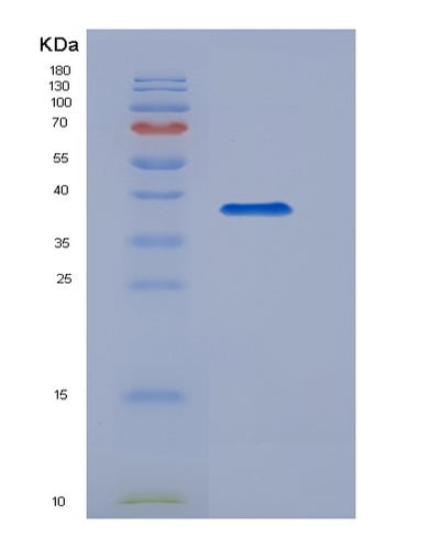 SDS-PAGE analysis of Human TBK1 (Serine/Threonine-Protein Kinase Tbk1) - Recombinant Protein, CAT# BLT-07278P, showing >90% purity under 15% SDS-PAGE (Reduced)Human TBK1 (Serine/Threonine-Protein Kinase Tbk1) - Recombinant Protein