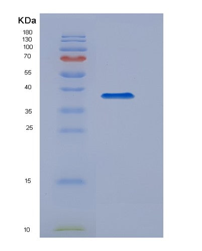 SDS-PAGE analysis of Human TBK1 (Serine/Threonine-Protein Kinase Tbk1) - Recombinant Protein, CATHuman TBK1 (Serine/Threonine-Protein Kinase Tbk1) - Recombinant Protein