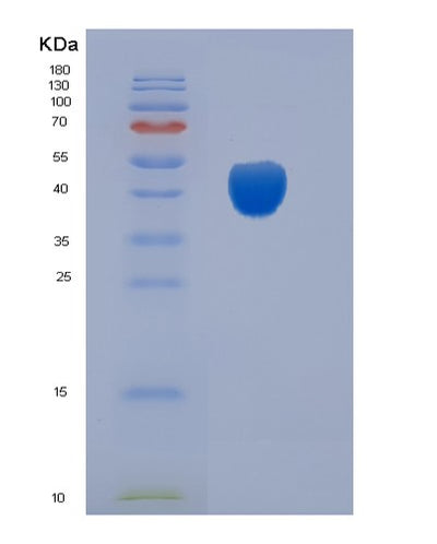 SDS-PAGE analysis of Mouse Cd200 (Ox-2 Membrane Glycoprotein) - Recombinant Protein, CAT# BLT-06225P, showing >90% purity under 15% SDS-PAGE (Reduced)Mouse Cd200 (Ox-2 Membrane Glycoprotein) - Recombinant Protein