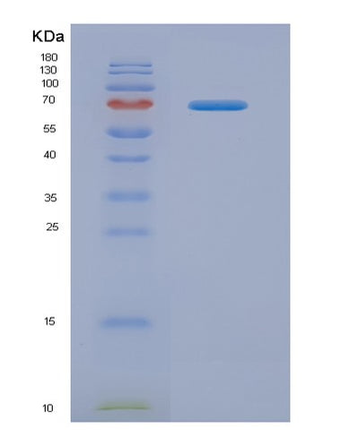SDS-PAGE analysis of Human SPP1 (Osteopontin) - Recombinant Protein, CAT# BLT-07282P, showing >90% purity under 15% SDS-PAGE (Reduced)Human SPP1 (Osteopontin) - Recombinant Protein