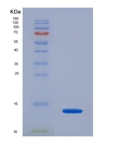 SDS-PAGE analysis of Human AMH (Muellerian-Inhibiting Factor) - Recombinant Protein, CAT# BLT-07284P, showing >90% purity under 15% SDS-PAGE (Reduced)Human AMH (Muellerian-Inhibiting Factor) - Recombinant Protein