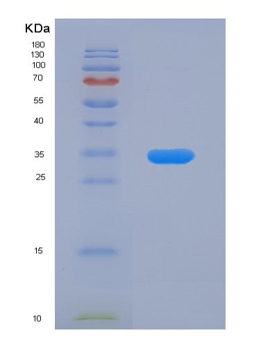 SDS-PAGE analysis of Human P2RX7 (P2X Purinoceptor 7) - Recombinant Protein, CATHuman P2RX7 (P2X Purinoceptor 7) - Recombinant Protein