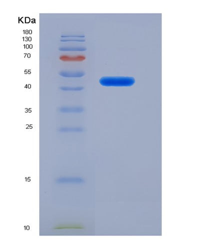 SDS-PAGE analysis of Mouse Serpina3n (Serine Protease Inhibitor A3N) - Recombinant Protein, CAT# BLT-07287P, showing >90% purity under 15% SDS-PAGE (Reduced)Mouse Serpina3n (Serine Protease Inhibitor A3N) - Recombinant Protein