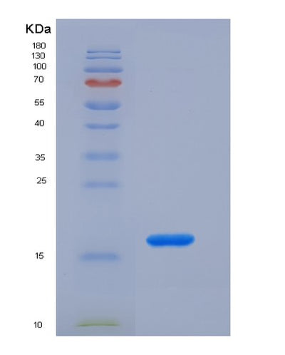 SDS-PAGE analysis of Human CCL2 (C-C Motif Chemokine 2) - Recombinant Protein, CAT# BLT-07288P, showing >90% purity under 15% SDS-PAGE (Reduced)Human CCL2 (C-C Motif Chemokine 2) - Recombinant Protein
