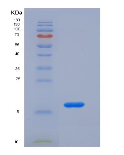 SDS-PAGE analysis of Human CCL2 (C-C Motif Chemokine 2) - Recombinant Protein, CATHuman CCL2 (C-C Motif Chemokine 2) - Recombinant Protein