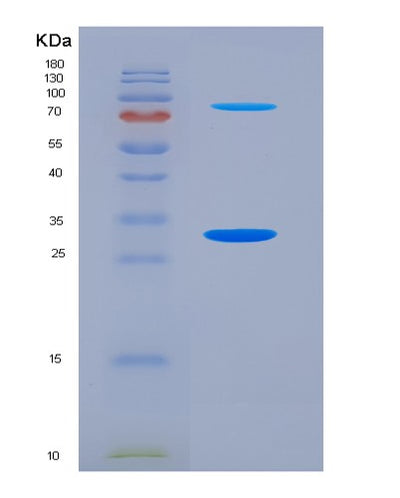 SDS-PAGE analysis of Human COL12A1 (Collagen Alpha-1(Xii) Chain) - Recombinant Protein, CAT# BLT-07290P, showing >90% purity under 15% SDS-PAGE (Reduced)Human COL12A1 (Collagen Alpha-1(Xii) Chain) - Recombinant Protein