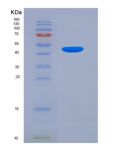 SDS-PAGE analysis of Mouse Penk (Proenkephalin-A) - Recombinant Protein, CAT# BLT-07291P, showing >90% purity under 15% SDS-PAGE (Reduced)Mouse Penk (Proenkephalin-A) - Recombinant Protein