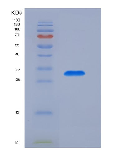 SDS-PAGE analysis of Human IRS1 (Insulin Receptor Substrate 1) - Recombinant Protein, CAT# BLT-07292P, showing >90% purity under 15% SDS-PAGE (Reduced)Human IRS1 (Insulin Receptor Substrate 1) - Recombinant Protein