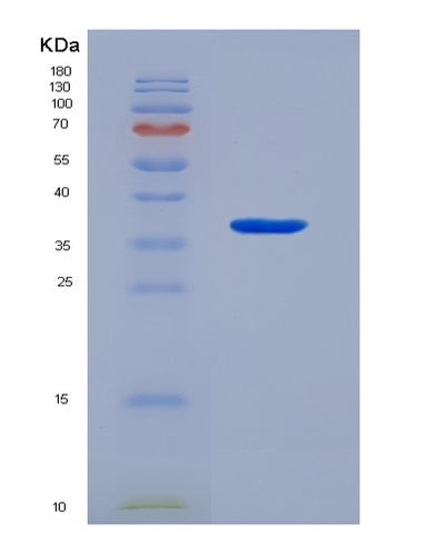 SDS-PAGE analysis of Mouse Anxa5 (Annexin A5) - Recombinant Protein, CAT# BLT-07294P, showing >90% purity under 15% SDS-PAGE (Reduced)Mouse Anxa5 (Annexin A5) - Recombinant Protein