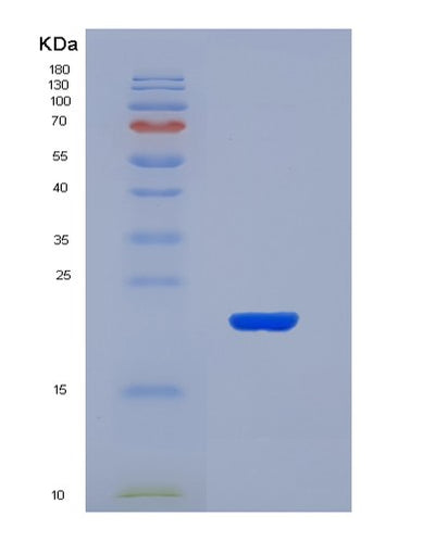 SDS-PAGE analysis of Human SLC5A1 (Sodium/Glucose Cotransporter 1) - Recombinant Protein, CAT# BLT-07295P, showing >90% purity under 15% SDS-PAGE (Reduced)Human SLC5A1 (Sodium/Glucose Cotransporter 1) - Recombinant Protein