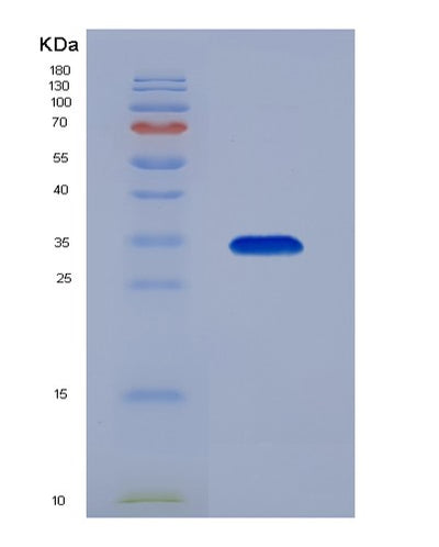 SDS-PAGE analysis of Mouse C4b (Complement C4-B) - Recombinant Protein, CAT# BLT-07297P, showing >90% purity under 15% SDS-PAGE (Reduced)Mouse C4b (Complement C4-B) - Recombinant Protein