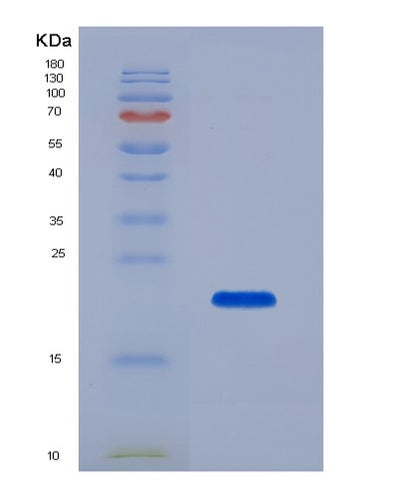 SDS-PAGE analysis of Human ATP1A1 (Sodium/Potassium-Transporting Atpase Subunit Alpha-1) - Recombinant Protein, CAT# BLT-07301P, showing >90% purity under 15% SDS-PAGE (Reduced)Human ATP1A1 (Sodium/Potassium-Transporting Atpase Subunit Alpha-1) - Recombinant Protein