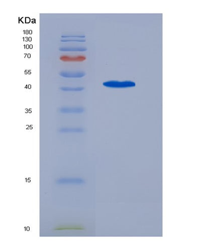 SDS-PAGE analysis of Human AIFM2 (Ferroptosis Suppressor Protein 1) - Recombinant Protein, CAT# BLT-07302P, showing >90% purity under 15% SDS-PAGE (Reduced)Human AIFM2 (Ferroptosis Suppressor Protein 1) - Recombinant Protein