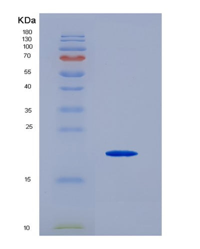 SDS-PAGE analysis of Human REG4 (Regenerating Islet-Derived Protein 4) - Recombinant Protein, CAT# BLT-02556P, showing >85% purity under 15% SDS-PAGE (Reduced)Human REG4 (Regenerating Islet-Derived Protein 4) - Recombinant Protein