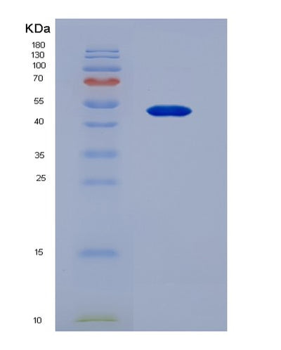 SDS-PAGE analysis of Human CHRNA7 (Neuronal Acetylcholine Receptor Subunit Alpha-7) - Recombinant Protein, CAT# BLT-07306P, showing >90% purity under 15% SDS-PAGE (Reduced)Human CHRNA7 (Neuronal Acetylcholine Receptor Subunit Alpha-7) - Recombinant Protein
