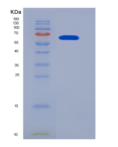 SDS-PAGE analysis of Human CAT (Catalase) - Recombinant Protein, CAT# BLT-07307P, showing >90% purity under 15% SDS-PAGE (Reduced)Human CAT (Catalase) - Recombinant Protein