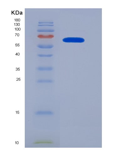 SDS-PAGE analysis of Human CAT (Catalase) - Recombinant Protein, CATHuman CAT (Catalase) - Recombinant Protein