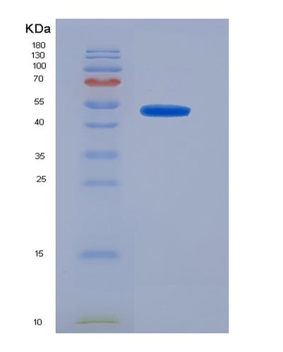 SDS-PAGE analysis of Human NR1H4 (Bile Acid Receptor) - Recombinant Protein, CAT# BLT-07308P, showing >90% purity under 15% SDS-PAGE (Reduced)Human NR1H4 (Bile Acid Receptor) - Recombinant Protein