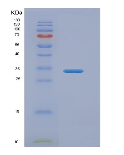 SDS-PAGE analysis of Human ASPA (Aspartoacylase) - Recombinant Protein, CAT# BLT-00241P, showing >95% purity under 15% SDS-PAGE (Reduced)Human ASPA (Aspartoacylase) - Recombinant Protein