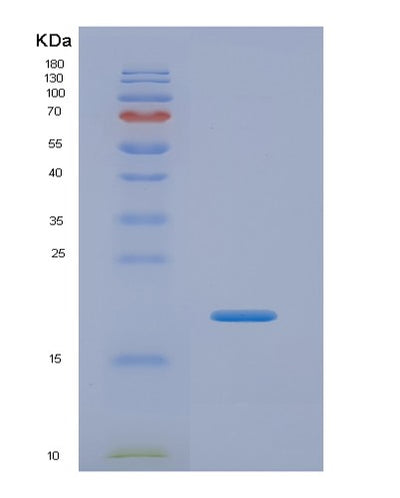 SDS-PAGE analysis of Human CPT1A (Carnitine O-Palmitoyltransferase 1, Liver Isoform) - Recombinant Protein, CAT# BLT-07309P, showing >90% purity under 15% SDS-PAGE (Reduced)Human CPT1A (Carnitine O-Palmitoyltransferase 1, Liver Isoform) - Recombinant Protein