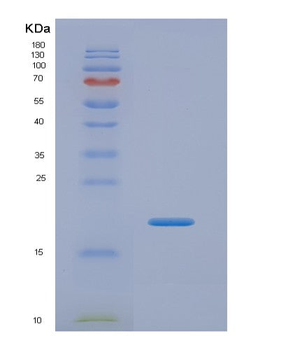 SDS-PAGE analysis of Human CPT1A (Carnitine O-Palmitoyltransferase 1, Liver Isoform) - Recombinant Protein, CATHuman CPT1A (Carnitine O-Palmitoyltransferase 1, Liver Isoform) - Recombinant Protein