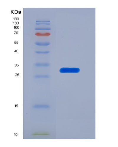 SDS-PAGE analysis of Human SELENOP (Selenoprotein P) - Recombinant Protein, CAT# BLT-07312P, showing >90% purity under 15% SDS-PAGE (Reduced)Human SELENOP (Selenoprotein P) - Recombinant Protein