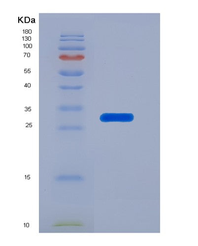 SDS-PAGE analysis of Human SELENOP (Selenoprotein P) - Recombinant Protein, CATHuman SELENOP (Selenoprotein P) - Recombinant Protein