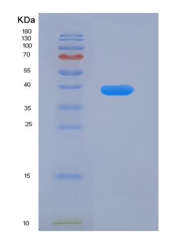 SDS-PAGE analysis of Human FLT1 (Vascular Endothelial Growth Factor Receptor 1) - Recombinant Protein, CAT# BLT-07313P, showing >90% purity under 15% SDS-PAGE (Reduced)Human FLT1 (Vascular Endothelial Growth Factor Receptor 1) - Recombinant Protein