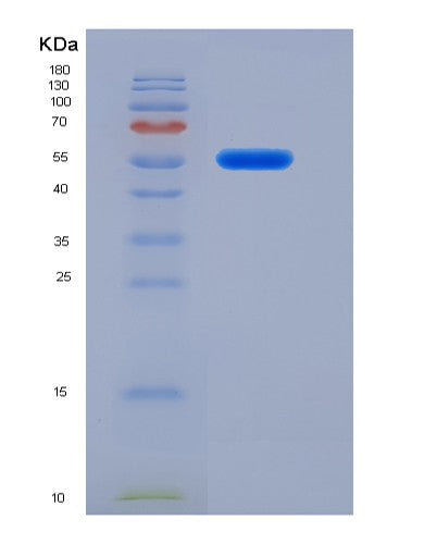 SDS-PAGE analysis of Human ITGB1 (Integrin Beta-1) - Recombinant Protein, CATHuman ITGB1 (Integrin Beta-1) - Recombinant Protein