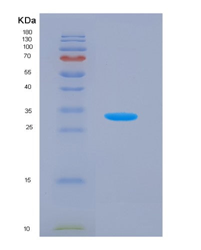 SDS-PAGE analysis of Human C9 (Complement Component C9) - Recombinant Protein, CATHuman C9 (Complement Component C9) - Recombinant Protein