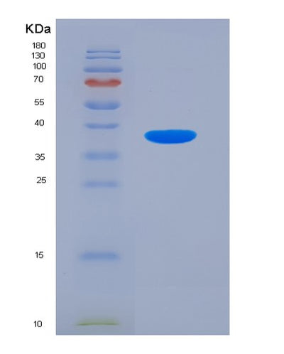 SDS-PAGE analysis of Human MBP (Myelin Basic Protein) - Recombinant Protein, CAT# BLT-07315P, showing >90% purity under 15% SDS-PAGE (Reduced)Human MBP (Myelin Basic Protein) - Recombinant Protein