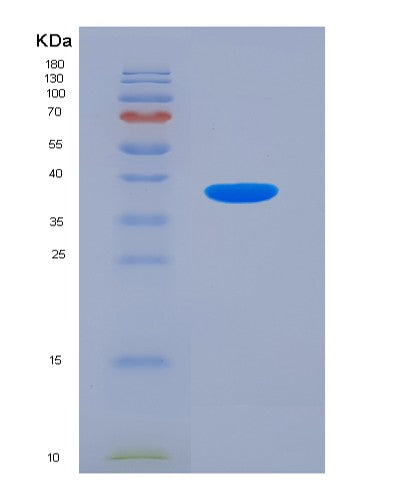 SDS-PAGE analysis of Human MBP (Myelin Basic Protein) - Recombinant Protein, CATHuman MBP (Myelin Basic Protein) - Recombinant Protein