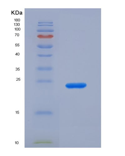 SDS-PAGE analysis of Human CRYAB (Alpha-Crystallin B Chain) - Recombinant Protein, CAT# BLT-00702P, showing >90% purity under 15% SDS-PAGE (Reduced)Human CRYAB (Alpha-Crystallin B Chain) - Recombinant Protein