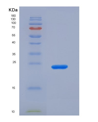 SDS-PAGE analysis of Human CRYAB (Alpha-Crystallin B Chain) - Recombinant Protein, CATHuman CRYAB (Alpha-Crystallin B Chain) - Recombinant Protein