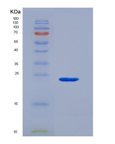 SDS-PAGE analysis of Mouse Cryab (Alpha-Crystallin B Chain) - Recombinant Protein, CAT# BLT-07316P, showing >90% purity under 15% SDS-PAGE (Reduced)Mouse Cryab (Alpha-Crystallin B Chain) - Recombinant Protein